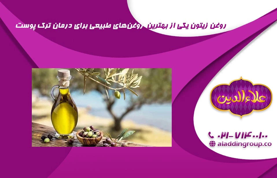 روغن زیتون مناسب برای درمان ترک پوستی